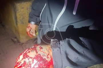 Tiroteo en Lomo de las Brujas de Jinámar con dos heridos/TA.